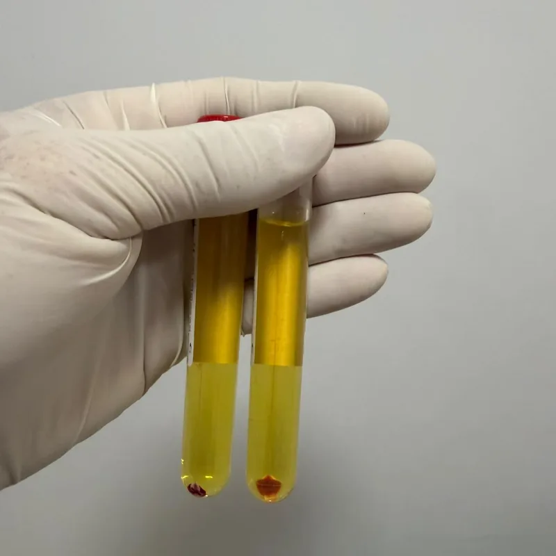 3. Plasma